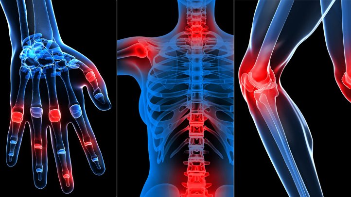 Oxygen therapy for rheumatology